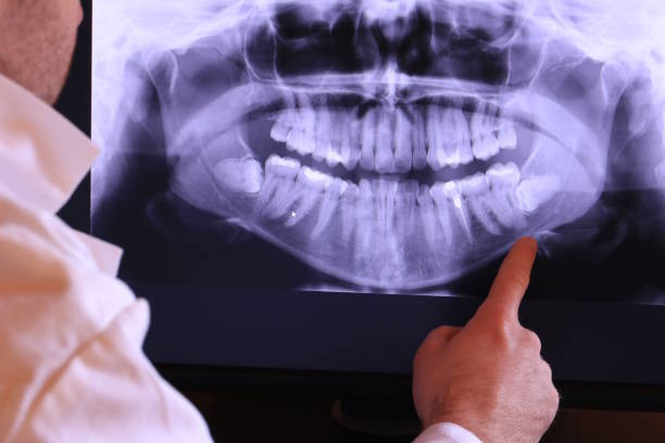 Best Emergency Dental Care for Broken or Chipped Teeth in Redding, CA