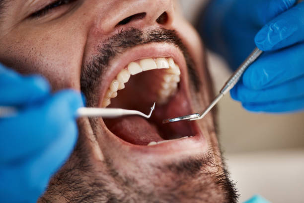 Best Cosmetic Emergency Dentistry in Redding, CA